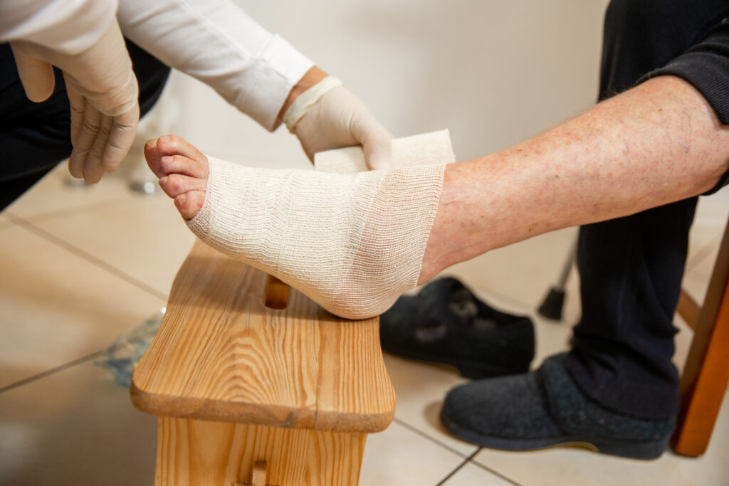Diabetic foot ulcer